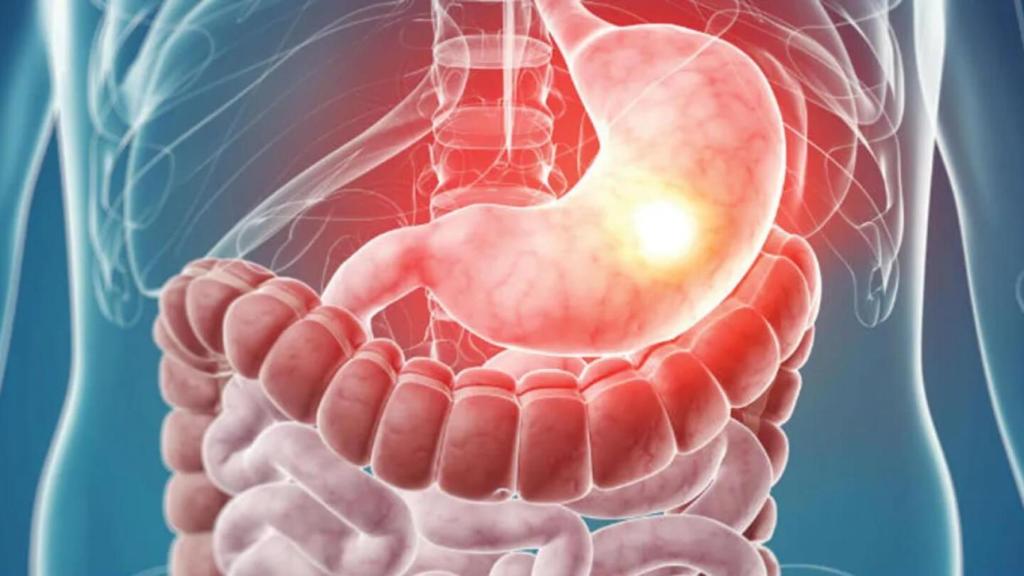 ¿Qué es la gastroenteritis y cómo evitarla?