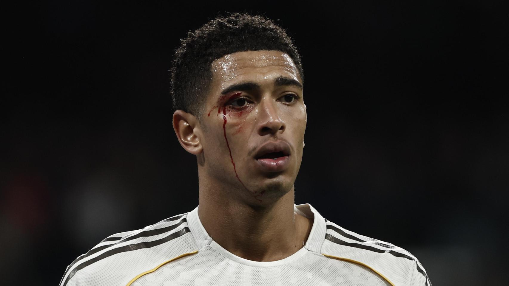 Jude Bellingham sangra del ojo tras un codazo de Borja Iglesias en el Real Madrid-Celta de Vigo