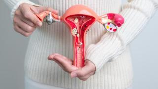 Així pots detectar els miomes uterins: símptomes, diagnòstic i com tractar-los