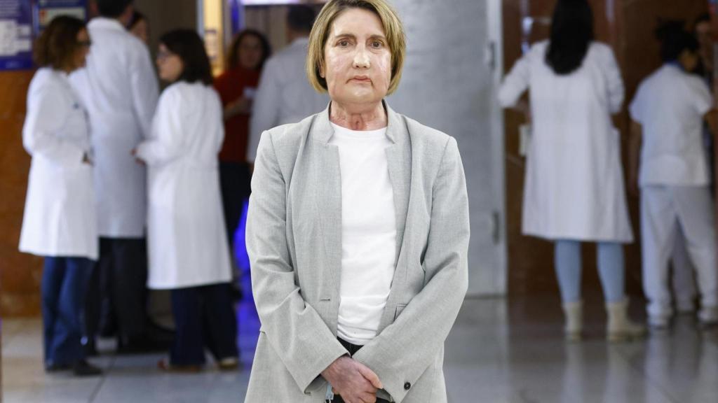 Primer trasplantament de cara del món d'una donant que va rebre una eutanàsia