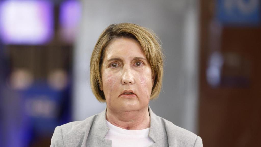 Primer trasplantament de cara del món d'una donant que va rebre una eutanàsia