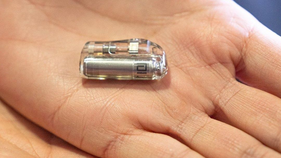 Marcapasos adaptado para bebés ideado por profesionales de Sant Joan de Déu y la empresa Abbott